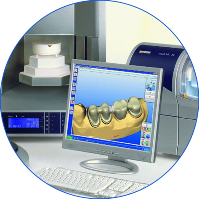 3D牙齿打印技术